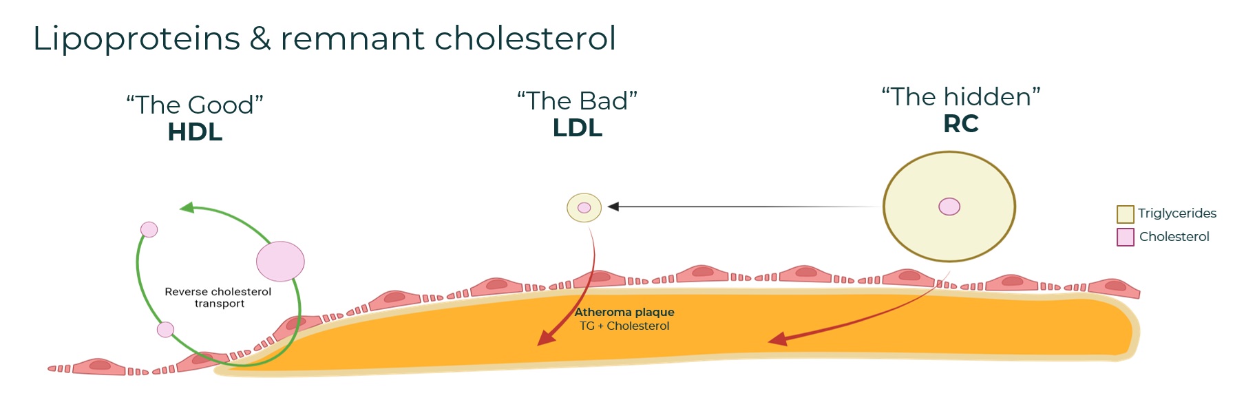 Remnant cholesterol is an emerging biomarker of Cardiovascular risk